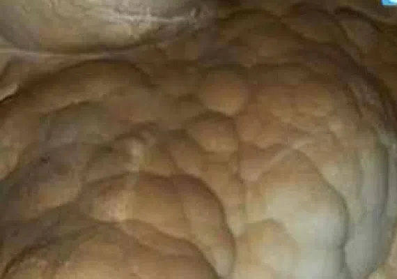غار میرزا
